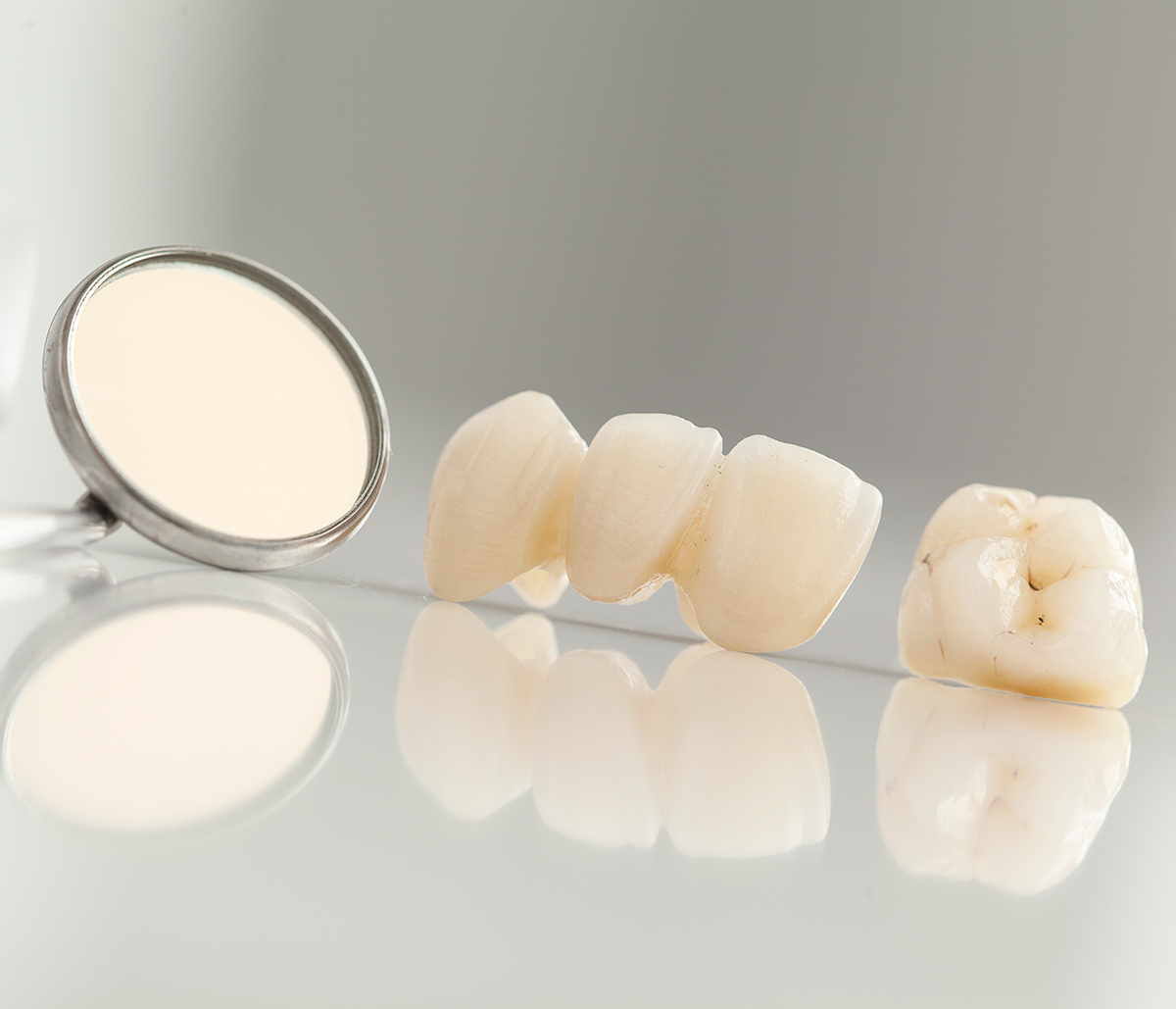 Kirkland, WA dentist describes dental crown and bridge procedures