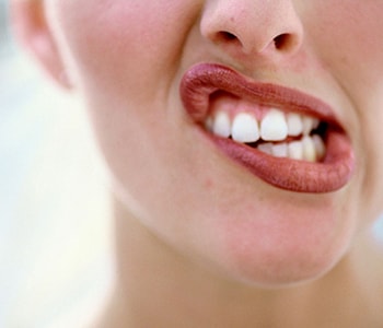 Professional teeth whitening services