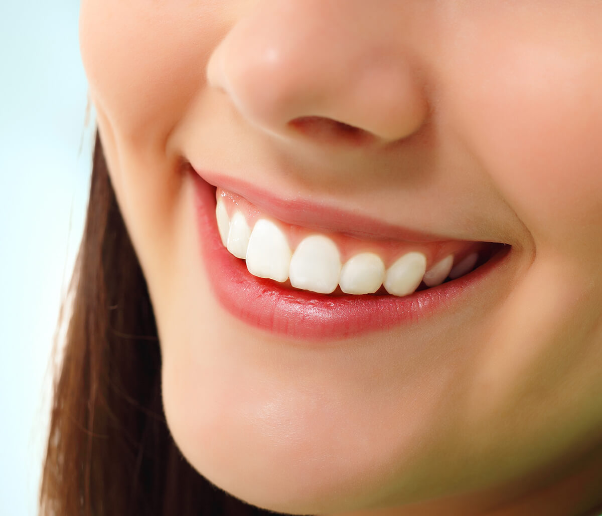 Teeth Whitening Services at Kingsgate Dental in Kirkland WA Area