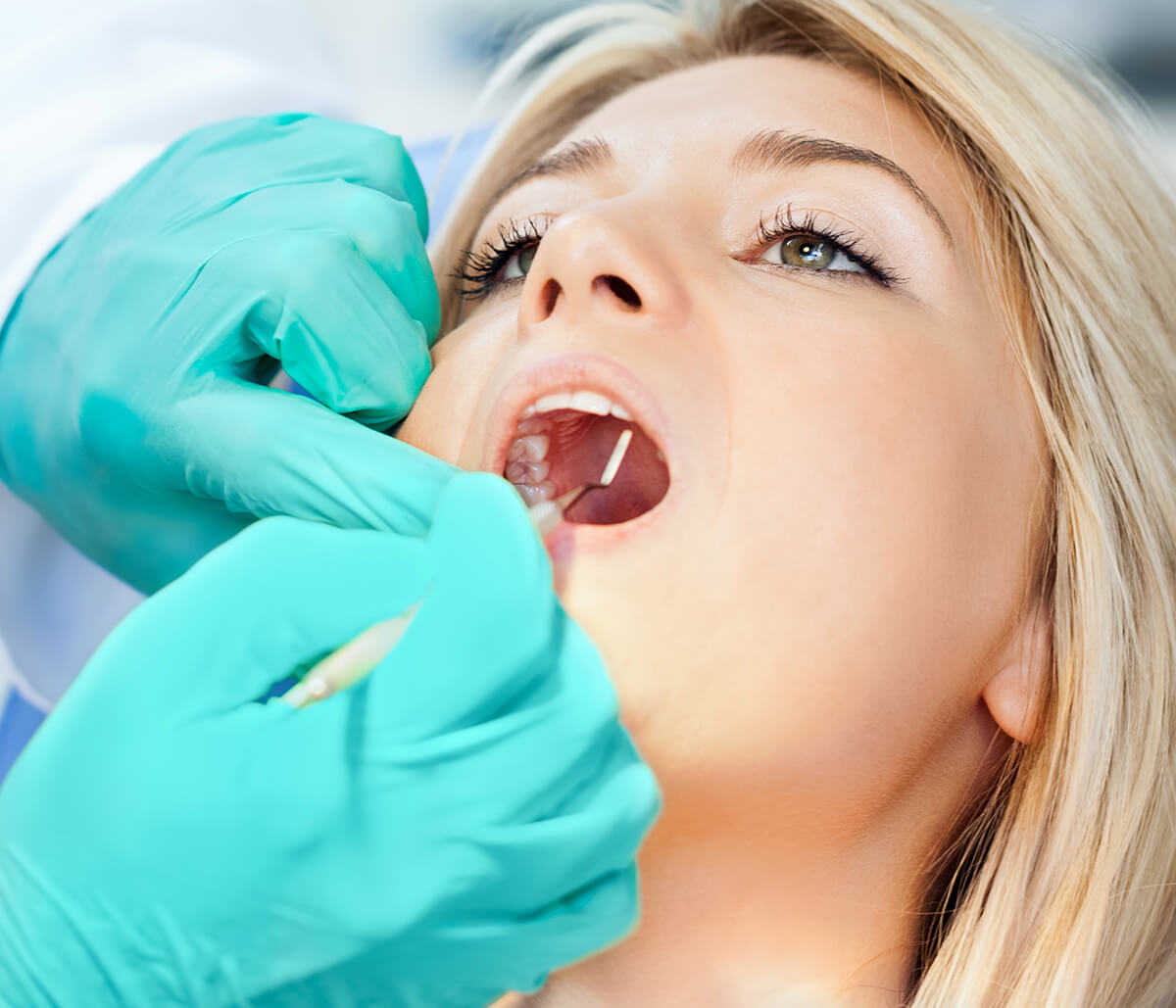 In Kirkland, WA Area, Dentist Offers Treatment for Gum Disease