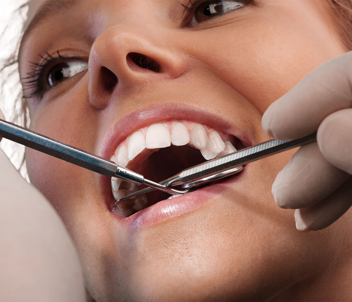 Gum Disease Dentist in Kirkland WA Area