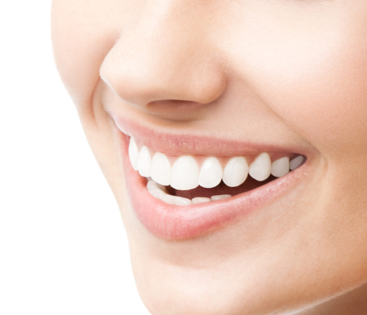 Effective Teeth Whitening Services in Kirkland Area