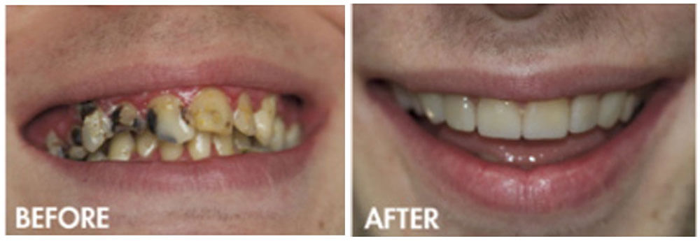 Kingsgate Dental Before and After Results