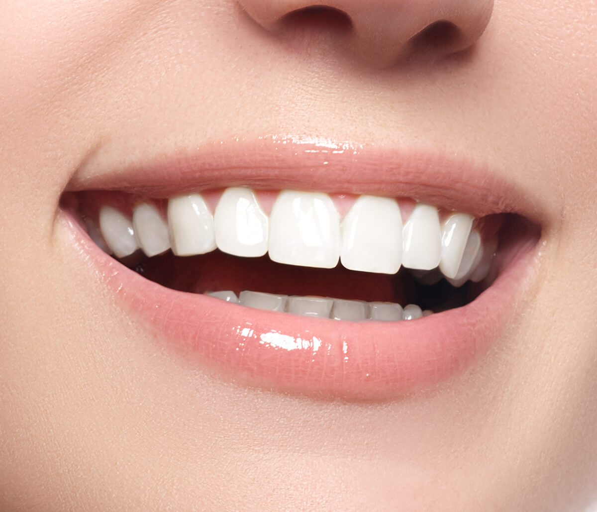 Teeth Whitening Treatments in Kirkland WA Area