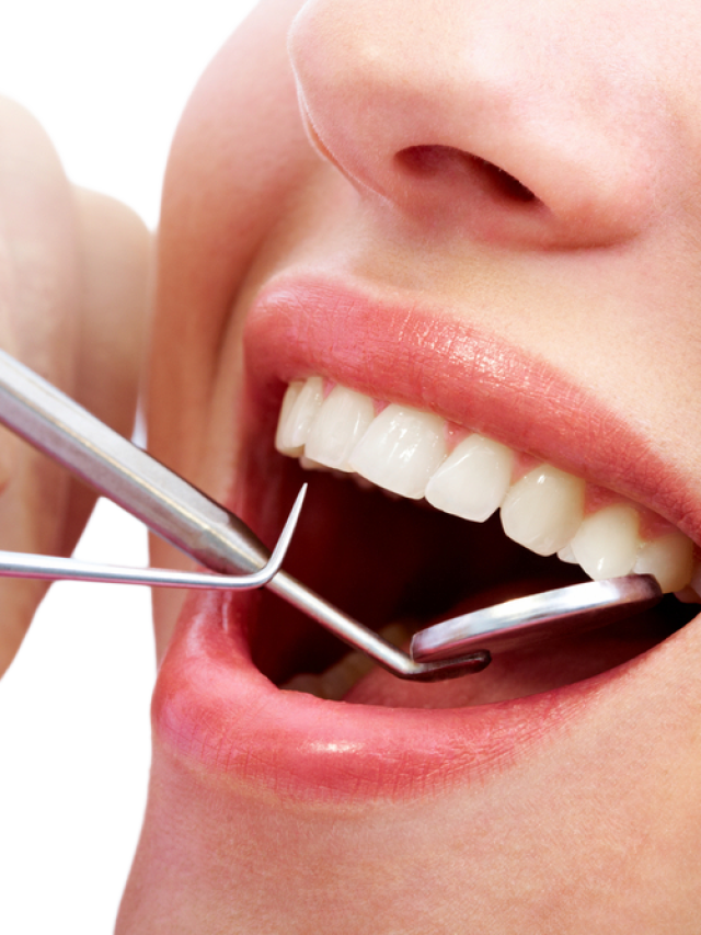 Strengthen and protect damaged teeth with Dental Fillings.